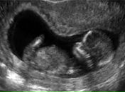 Фотография Бокатой Елены